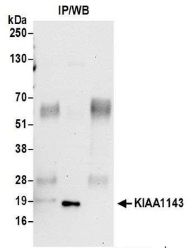 KIAA1143 Antibody