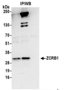 ZCRB1 Antibody