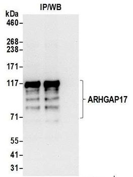 ARHGAP17 Antibody