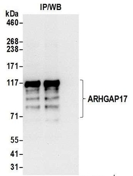 Rabbit anti-ARHGAP17 Antibody