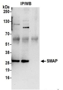 SMAP Antibody