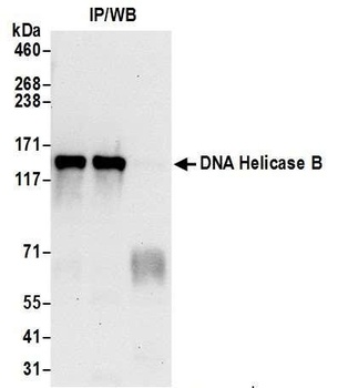 DNA Helicase B Antibody