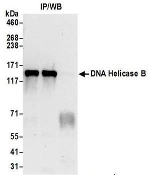 Rabbit DNA Helicase B Antibody