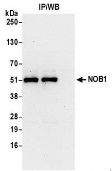 Rabbit anti-NOB1 Antibody