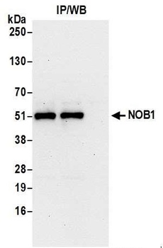 NOB1 Antibody