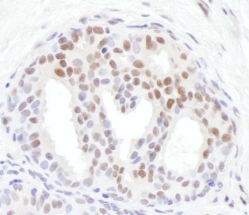 Rabbit anti-Phospho Chk1 (S317) Antibody