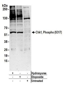 Rabbit anti-Phospho Chk1 (S317) Antibody