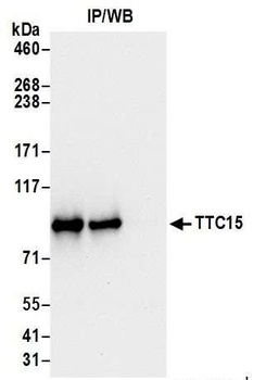 TTC15 Antibody