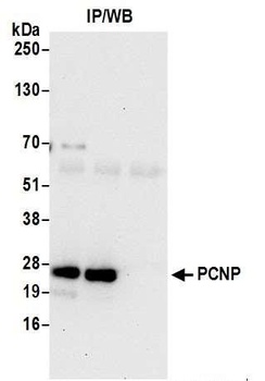 Rabbit anti-PCNP Antibody
