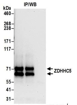 ZDHHC5 Antibody