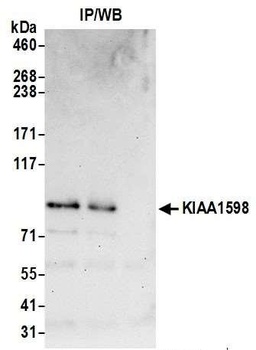 KIAA1598 Antibody
