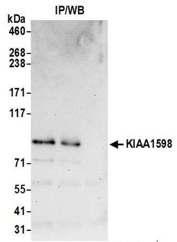 Rabbit KIAA1598 Antibody