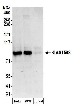 Rabbit KIAA1598 Antibody