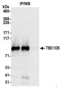 Rabbit anti-TBC1D5 Antibody