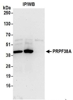 PRPF38A Antibody