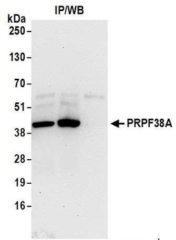 Rabbit anti-PRPF38A Antibody