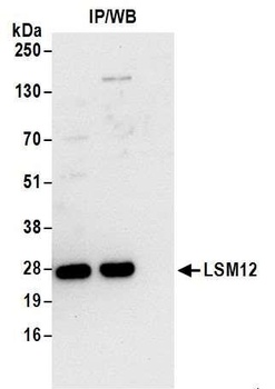 LSM12 Antibody