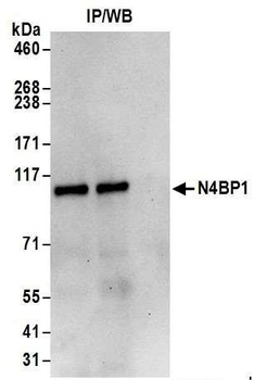 N4BP1 Antibody