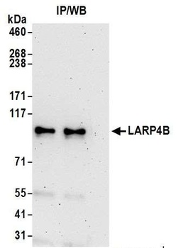 Rabbit LARP4B Antibody