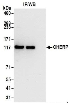 Rabbit anti-CHERP Antibody