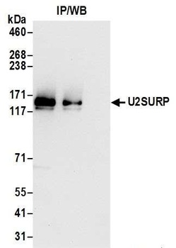 U2SURP Antibody