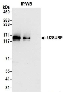 Rabbit anti-U2SURP Antibody