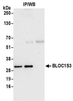 Rabbit anti-BLOC1S3 Antibody