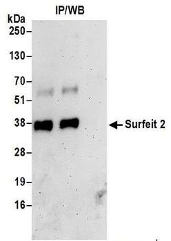 Surfeit 2 Antibody