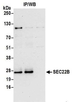 Rabbit anti-SEC22B Antibody