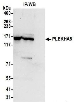 PLEKHA5 Antibody