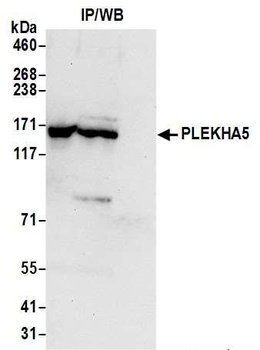 Rabbit PLEKHA5 Antibody
