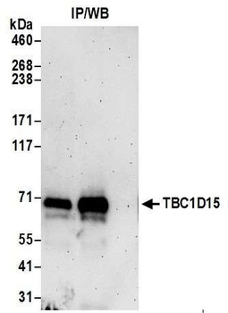 TBC1D15 Antibody