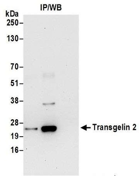 Rabbit anti-Transgelin 2 Antibody
