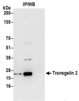 Transgelin 2 Antibody