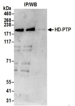 Rabbit HD-PTP Antibody