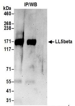 LL5beta Antibody