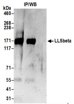 Rabbit LL5beta Antibody