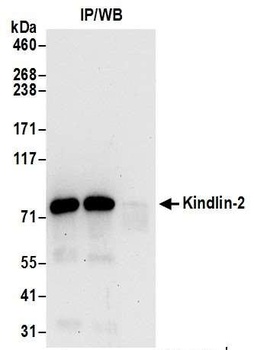 Kindlin-2 Antibody