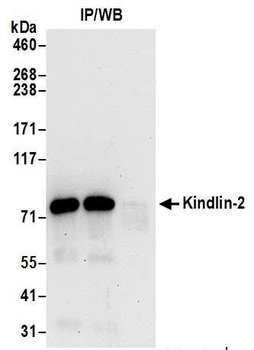 Rabbit Kindlin-2 Antibody