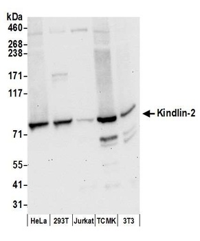 Rabbit Kindlin-2 Antibody