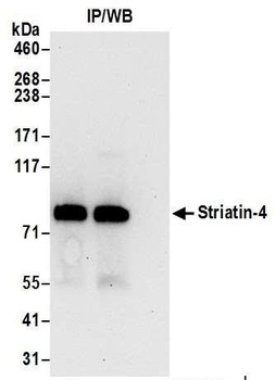Rabbit anti-Striatin-4 Antibody