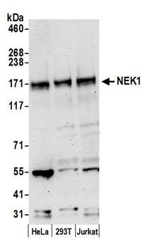Rabbit NEK1 Antibody