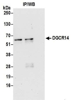 Rabbit anti-DGCR14 Antibody