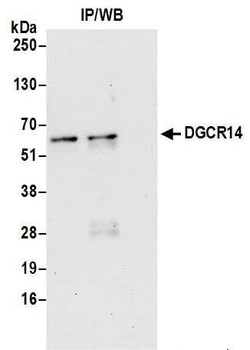 DGCR14 Antibody