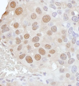 PCYT1A Antibody