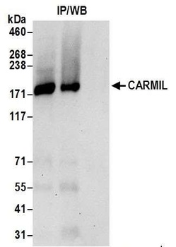 Rabbit anti-CARMIL Antibody