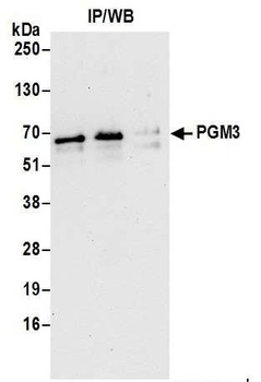 PGM3 Antibody