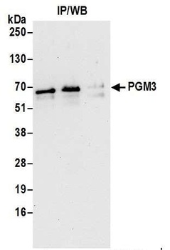 Rabbit anti-PGM3 Antibody
