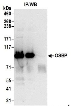Rabbit OSBP Antibody