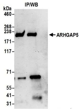ARHGAP5 Antibody